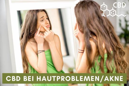 CBD (Cannabidiol) bei Akne und Hautproblemen